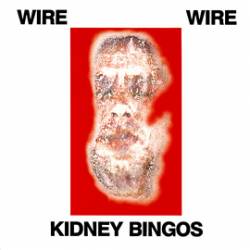 Wire : Kidney Bingos